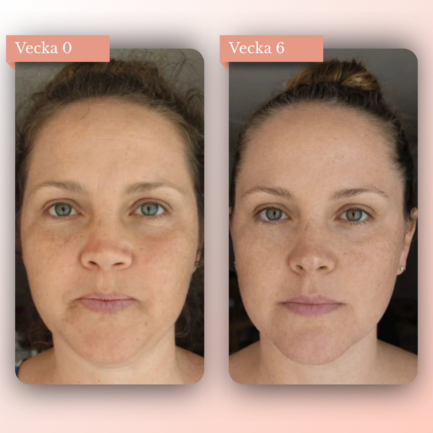 Lumvit Sculpt
